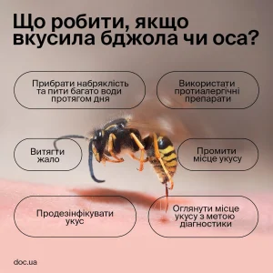що робити якщо вкусив шершень