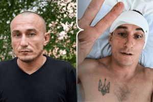 Нема часу лікуватися Херсонський волонтер БФ «Справжні» про поранення через атаку дрона та повернення до роботи